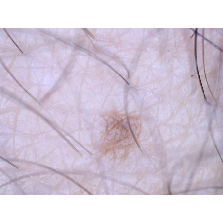 Microscop digital Delta Smart 5MP PRO